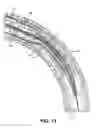 Fig. 14 - Ultrasound transducer array having a flexible substrate