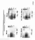 Fig. 19 - Detection, imaging and characterization of breast tumors