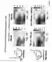 Fig. 20 - Detection, imaging and characterization of breast tumors