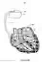 Fig. 03 - Sleep disordered breathing alert system