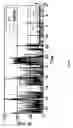 Fig. 09 - Sleep disordered breathing alert system