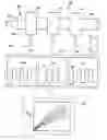 Fig. 01 - Non-invasive device and method for the diagnosis of pulmonary vascular occlusions