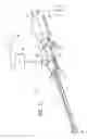 Fig. 02 - Tissue accessing and anchoring device and method