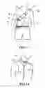 Fig. 13 - Hanging electro-stimulating massage belt