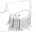 Fig. 01 - Adjustable soft neck brace