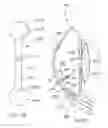 Fig. 14 - Implant having MEMS flow module with movable, flow-controlling baffle