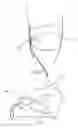 Fig. 05 - Tampon applicator having a rupturable membranous cap