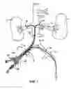 Fig. 02 - Sheath for use in peripheral interventions