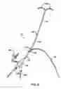 Fig. 04 - Sheath for use in peripheral interventions
