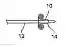 Fig. 01 - Method and system for deploying protective sleeve in intraluminal catherization and dilation
