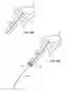 Fig. 05 - Method and system for deploying protective sleeve in intraluminal catherization and dilation