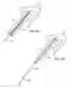 Fig. 06 - Method and system for deploying protective sleeve in intraluminal catherization and dilation