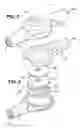 Fig. 06 - Flow restrictor device for a medical apparatus