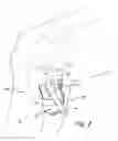 Fig. 04 - Device for collecting surgical material