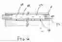 Fig. 07 - Liquid removal method and apparatus for surgical procedures