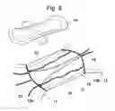 Fig. 06 - Panty