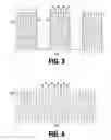 Fig. 04 - Method and system for photoselective vaporization for gynecological treatments
