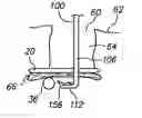 Fig. 01 - Tissue removal probe with sliding burr in cutting window