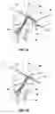 Fig. 05 - Method and implant for securing ligament replacement into the knee