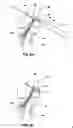 Fig. 06 - Method and implant for securing ligament replacement into the knee