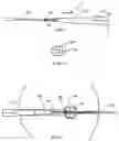 Fig. 10 - Method and implant for securing ligament replacement into the knee