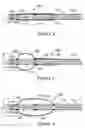 Fig. 03 - Occlusion balloon catheter with longitudinally expandable balloon
