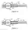 Fig. 05 - Occlusion balloon catheter with longitudinally expandable balloon