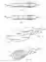 Fig. 05 - Medical electrode for preventing the passage of harmful current to a patient