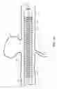 Fig. 04 - Medical devices including metallic films and methods for making same