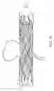 Fig. 05 - Medical devices including metallic films and methods for making same
