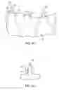 Fig. 12 - Medical devices including metallic films