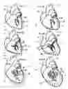 Fig. 02 - Systems for heart treatment