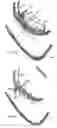 Fig. 06 - Systems for heart treatment