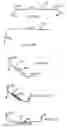 Fig. 08 - Systems for heart treatment