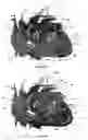 Fig. 31 - Systems for heart treatment