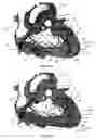Fig. 32 - Systems for heart treatment
