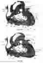 Fig. 33 - Systems for heart treatment