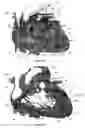Fig. 35 - Systems for heart treatment