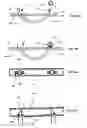 Fig. 46 - Systems for heart treatment