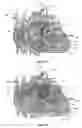 Fig. 51 - Systems for heart treatment