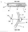Fig. 53 - Systems for heart treatment
