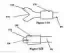 Fig. 55 - Systems for heart treatment