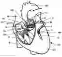 Fig. 01 - Systems for heart treatment