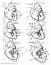 Fig. 02 - Systems for heart treatment
