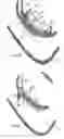 Fig. 06 - Systems for heart treatment