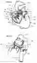 Fig. 13 - Systems for heart treatment