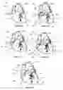 Fig. 14 - Systems for heart treatment