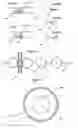 Fig. 19 - Systems for heart treatment