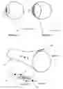 Fig. 22 - Systems for heart treatment
