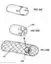 Fig. 23 - Systems for heart treatment